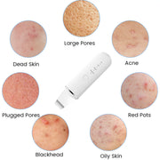 USB Rechargeable Ultrasonic Facial Skin Scrubber – Electric Pore Deep Cleansing Spatula with 250mAh Battery, 4 Modes, and Blackhead Scraper | Portable Skin Care Beauty Tool