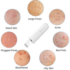 USB Rechargeable Ultrasonic Facial Skin Scrubber – Electric Pore Deep Cleansing Spatula with 250mAh Battery, 4 Modes, and Blackhead Scraper | Portable Skin Care Beauty Tool